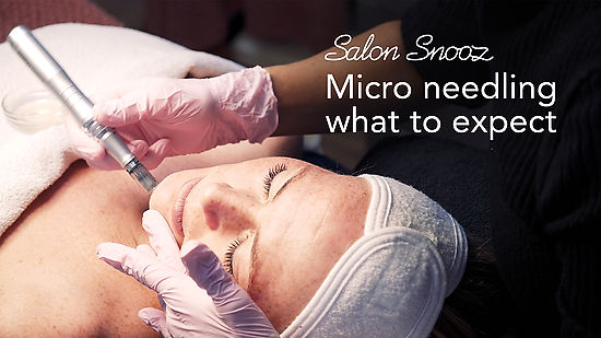 Salon Snooz - Micro needling what to expect
